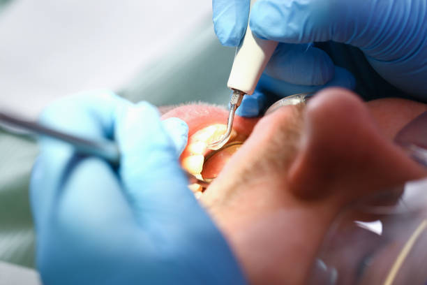 Best After-Hours Emergency Dentist in Vienna, GA