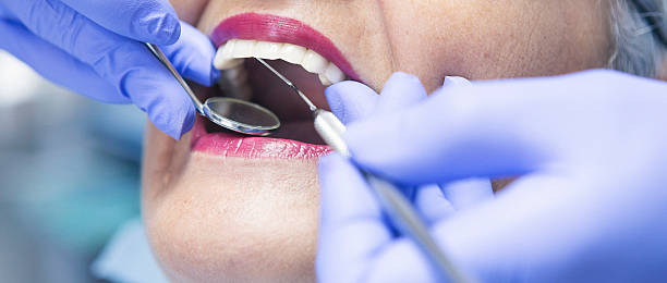 Best Emergency Root Canal Treatment in Vienna, GA